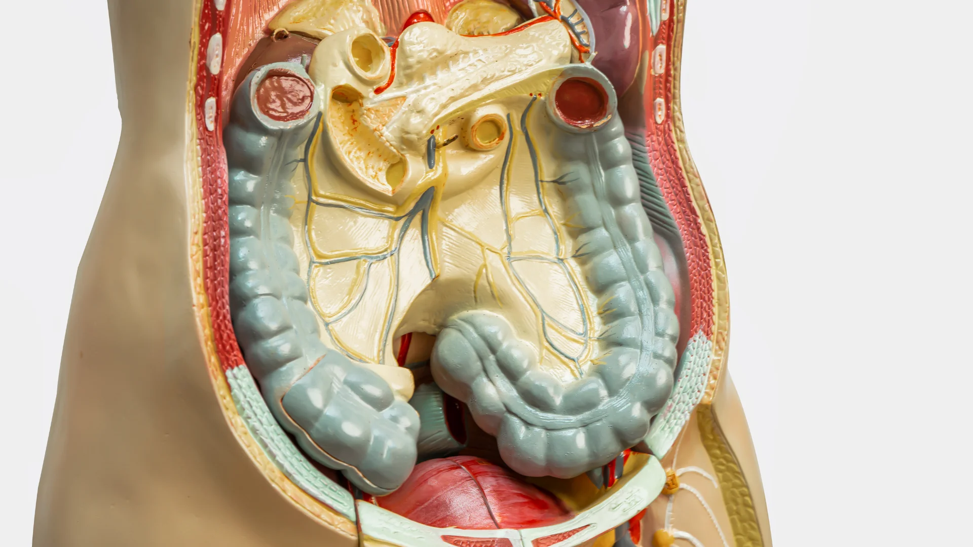 Histórico familiar de câncer intestinal